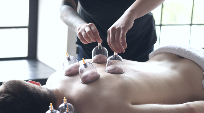 What Is Cupping? The Alternative Therapy You Might Consider